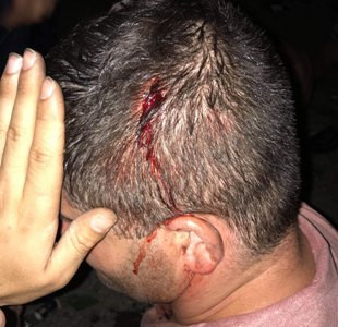 11 people, including 8 police, hospitalized after clashes between police and demonstrators in Ijevan (PHOTOS)