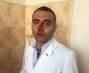 «Ժողովուրդ». Գումարը չե՞ն կարողացել կիսել. ինչու է ուռուցքաբանության կենտրոնի «բռնցքամարտիկ» տնօրենը կոտրել բժշկի քիթը