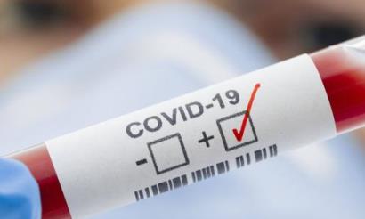 Armenia's Vayots Dzor Province reports coronavirus case