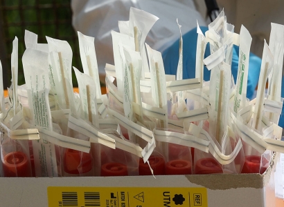 RBC: Russia provides necessary amount of coronavirus diagnostic test systems to Armenia
