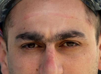 Armenia health minister posts photos of medical workers' faces