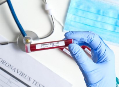 Pashinyan: We have 977 confirmed cases of coronavirus in Armenia