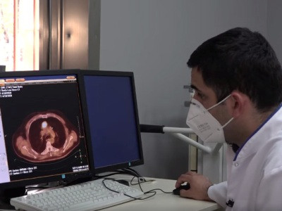 ՀՀ-ում կանցկացվեն քաղցկեղի ախտորոշման բացառիկ հետազոտություններ. Սարքը մետաստազը ցույց է տալիս սկզբնական փուլում