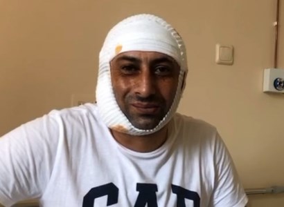 Չէի պատկերացնում, որ Սումգայիթի սարսափը կվերապրեմ Մոսկվայում. ադրբեջանցիների հարձակումից տուժած քաղաքացի (վիդեո)