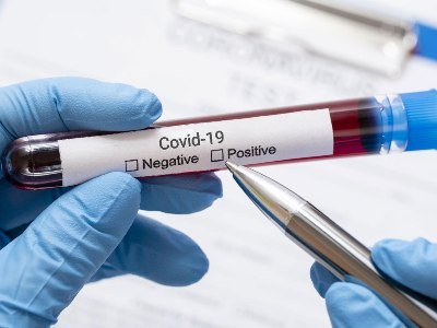COVID-19 in Armenia: 168 new cases reported