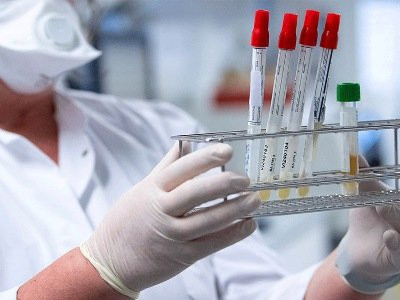 392 new cases of COVID-19 confirmed in Armenia