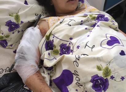 Karabakh Ombudsman visits civilians wounded as a result of Azerbaijani aggression