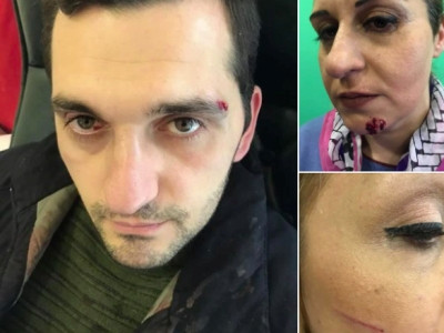 Oppositionists attacked in Yerevan