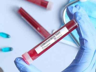 Seven new cases of coronavirus reported in Karabakh