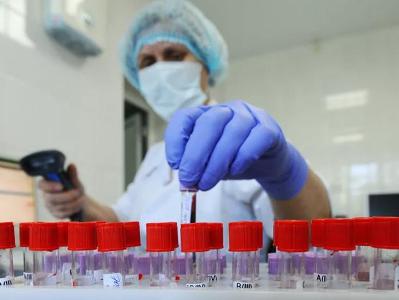 1,029 new cases of COVID-19 confirmed in Armenia
