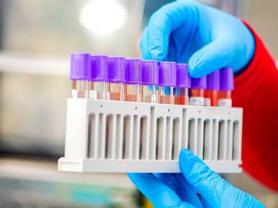 808 new cases of COVID-19 confirmed in Armenia