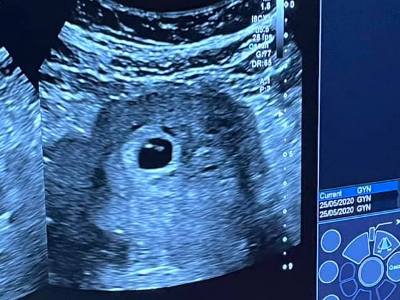 Armenian doctor: Today we received first of mothers of deceased soldiers who had become pregnant