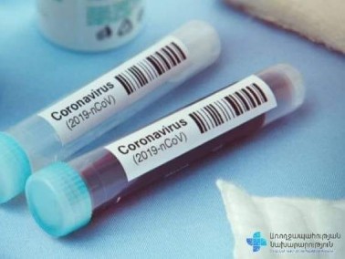 Armenia confirms over 130 COVID-19 new cases