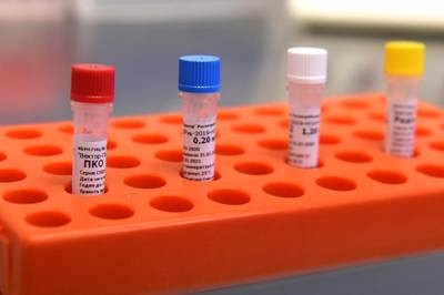 Armenia reports COVID-19 new 81 cases: 4 people die