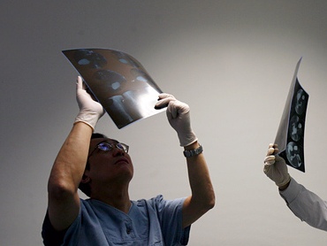Over 60 children in UK undergo surgery due to TikTok challenge