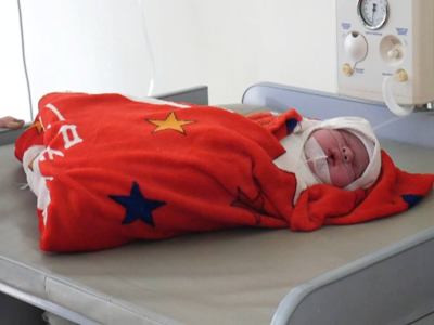 Armenian boy weighing 5 kg born at Goris Medical Center