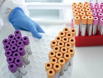 53 new cases of COVID-19 confirmed in Armenia