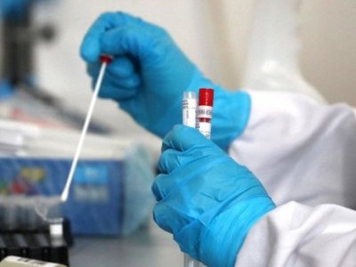 280 COVID-19 new cases reported in Armenia per day