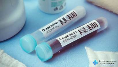 Armenia confirms 423 COVID-19 new cases in a day