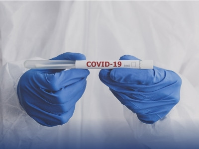 1,309 new cases of COVID-19 confirmed in Armenia