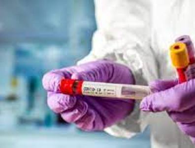 4 more persons die of coronavirus in Artsakh