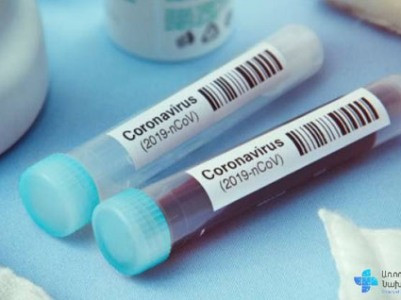 Specialist: Increase in number of Covid cases in Armenia in recent days is due to Omicron variant