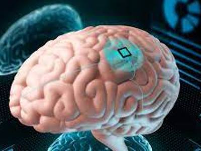 Elon Musk's Neuralink to embed microchips in people's brain and to perform brain surgery