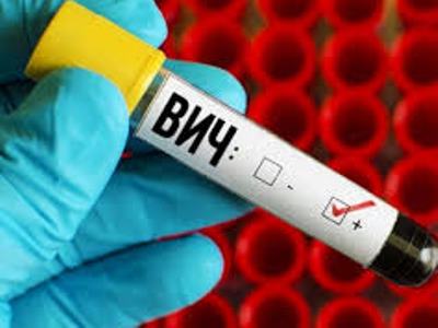 Example of Tolerance: In Azerbaijan, HIV-positive people banned from work in number of spheres