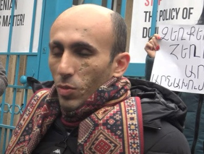 Советник госминистра Карабаха: Могу прибегнуть к более жестким формам акции протеста