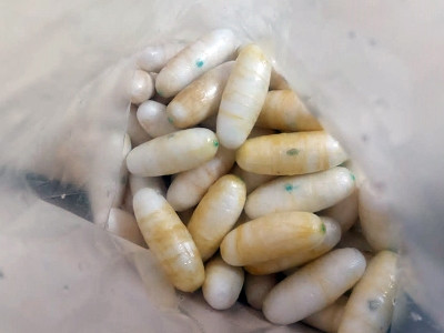More than $300,000 worth of cocaine found in large intestine of airline passenger who arrived in Armenia from Brazil