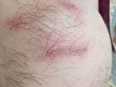 Man who impersonates Karabakh president is beaten at police station