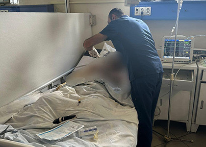 234 people forcibly displaced from Nagorno-Karabakh continue medical treatment in Armenia