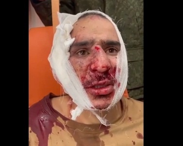 Interrogation of the last detained “Crocus” terrorist published: he was shot in the ear