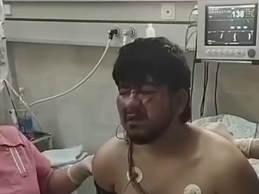 Footage of one of “Crocus” terrorists being interrogated in a hospital room published