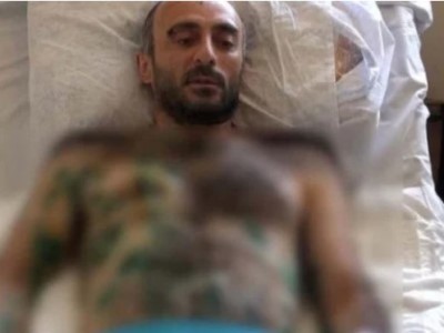 Есаи Карамян: Если бы я знал, что это граната, то попытался сбежать