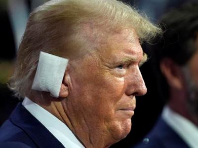 Trump appeared at Republican Party convention with a bandaged ear