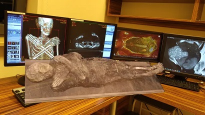 Mystery of mummy of ‘pregnant woman who died of cancer’ solved