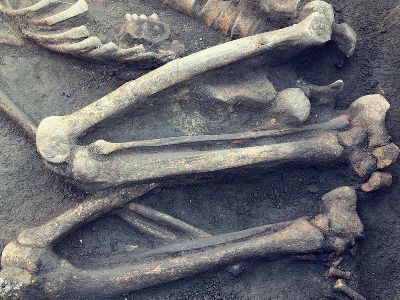 US woman arrested on charges of buying, selling human bones