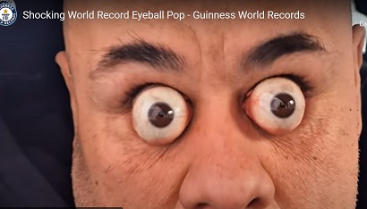 Man who can pop his eyeballs out by almost 2cm sets world record