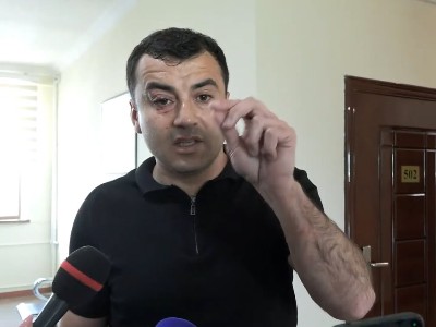 Փորձում են ոստիկանության միջոցով ծածկադմփոց անել. Արթուր Չախոյան