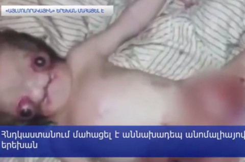 «Այլմոլորակային» երեխան մահացել է
