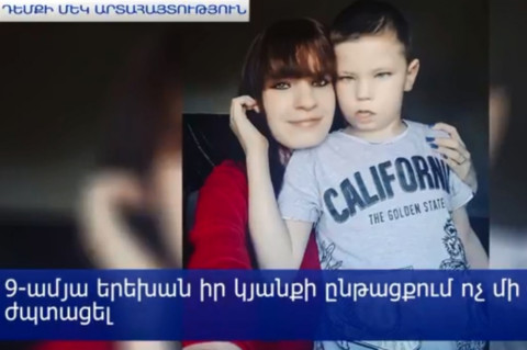 9-ամյա երեխան զրկված է ժպտալու հնարավորությունից