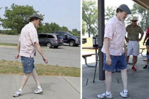 American man walks with his feet rotated 180 degrees backward
