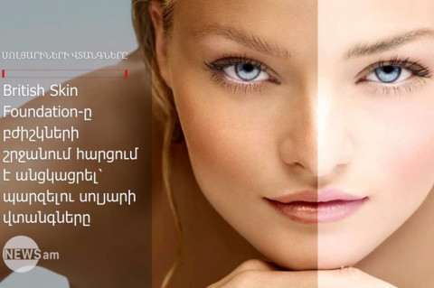 Ինչու՞ են սոլյարիներն այդքան վտանգավոր