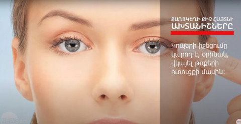 Քաղցկեղի 5 ախտանիշ, որոնք անտեսվում են շատերի կողմից