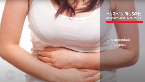 Հաստ աղիի քաղցկեղի գլխավոր նշանները