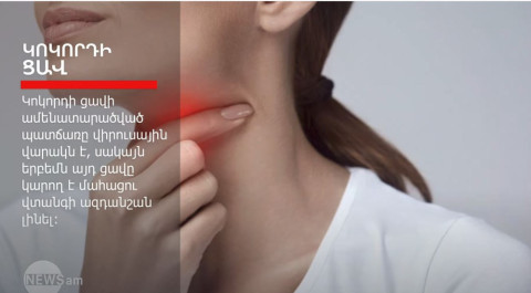 Կոկորդի ցավ. ե՞րբ է այն վտանգավոր