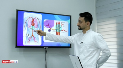 Քաղցկեղի դեղորայքային բուժման ամենաօպտիմալ մեթոդներն են թիրախային եւ իմունաթերապիան. Լեւոն Բադալյան