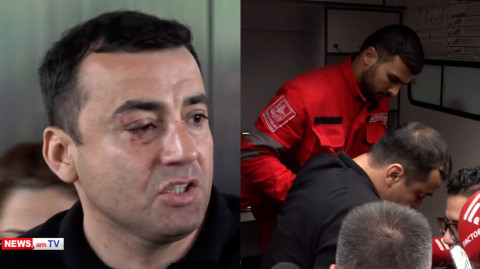 «Շտապօգնությունը» Չախոյանին ոստիկանությունից հիվանդանոց տեղափոխեց