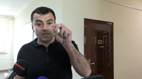 Ով ինձ վրա հարձակվում է, ծեծում է բաժին չեն տանում, ինձ բաժին են հրավիրում. Արթուր Չախոյան